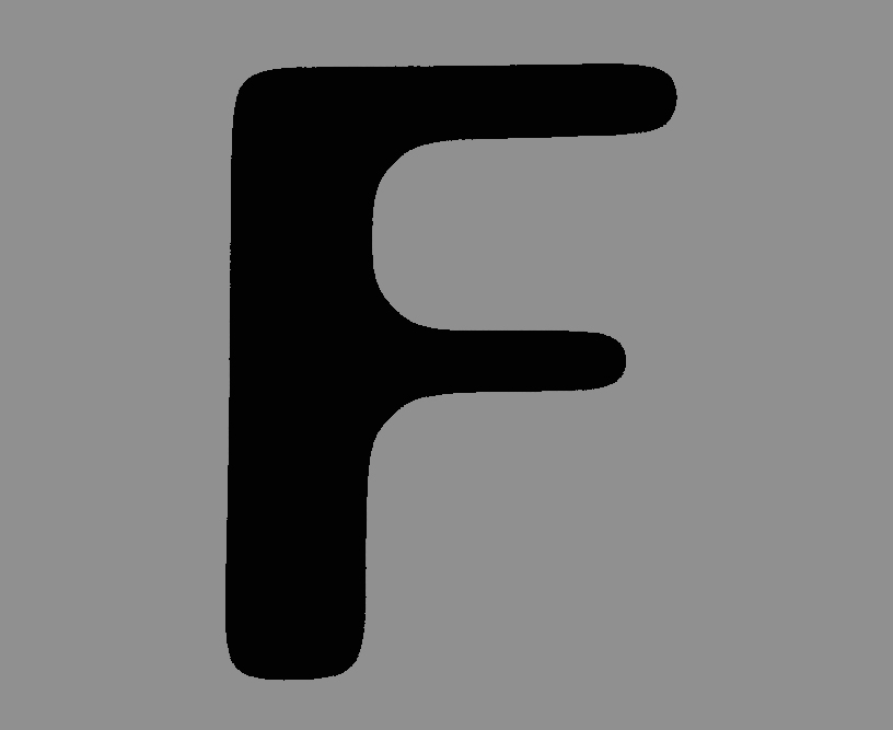 F - Lasik Surgery
